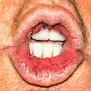 Orange Be Gone